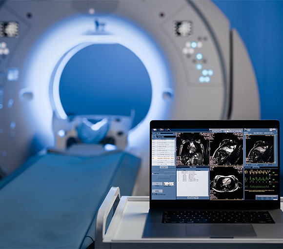 Advanced medical imaging equipment with a laptop displaying cardiac images and a CT scanner.