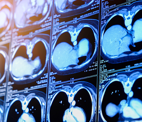 Cardiac CT scans displaying detailed images of the heart and surrounding structures.