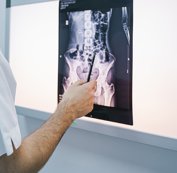 A radiologist examining a spinal X-ray for diagnostic purposes.