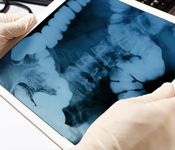 X-ray image of a patient's gastrointestinal tract being examined by a radiologist.